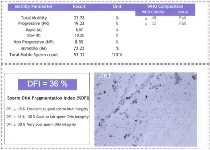 查出精子碎片率高