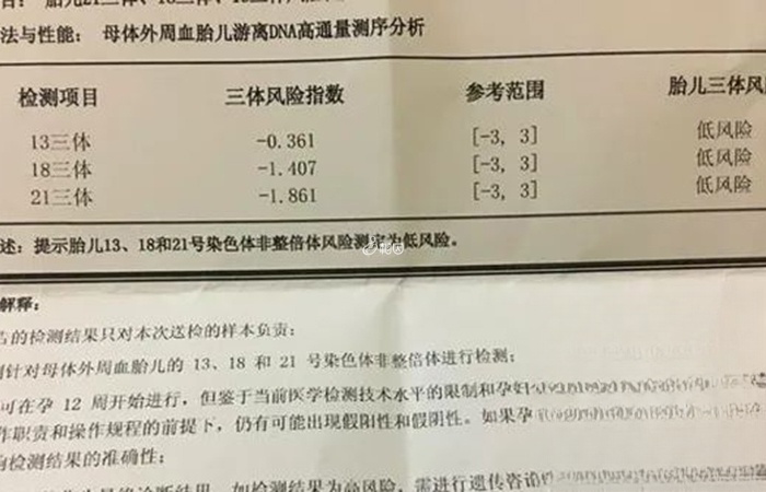 在长春市做一次无创DNA检查的价格不高