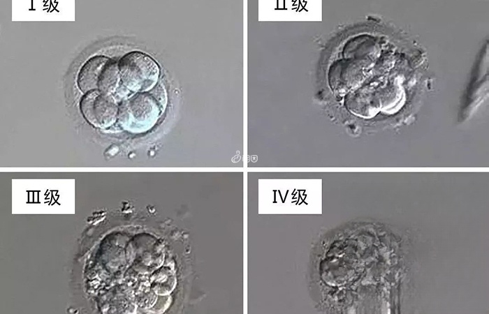 囊胚的质量等级和胚胎性别是没有关系的
