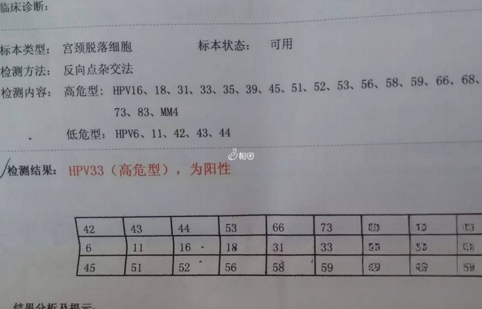 想解读HPV检查报告单主要看阴性和阳性两个词汇