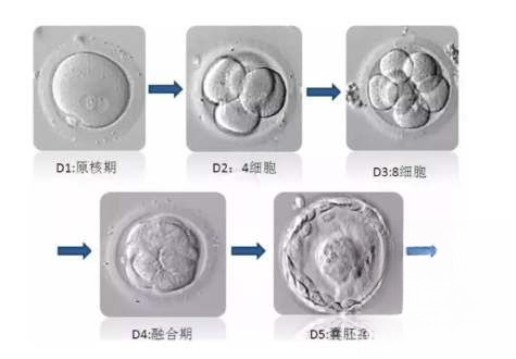 泰国BNH医院养囊技术怎么样