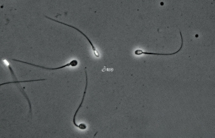 男性的正常形态精子比例为4%就是最低的