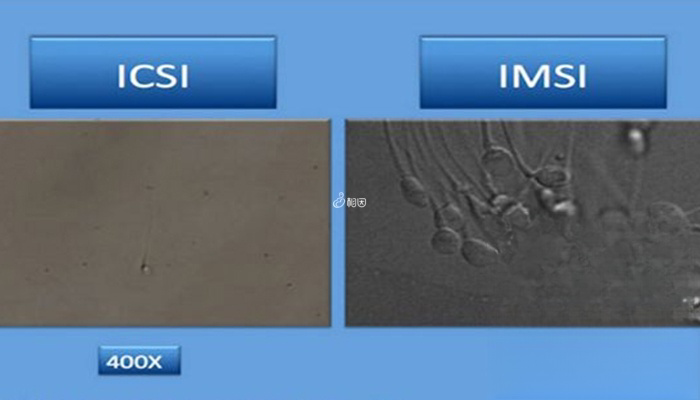 IMSI技术可放大精子6600倍