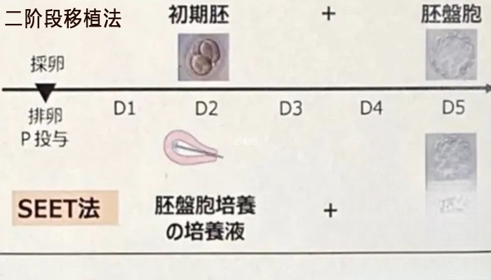 日本有SEET/二阶段移植法