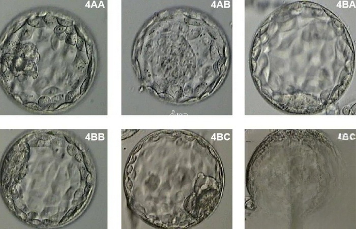 3BC囊胚比4BC成功率高是有一定原因的