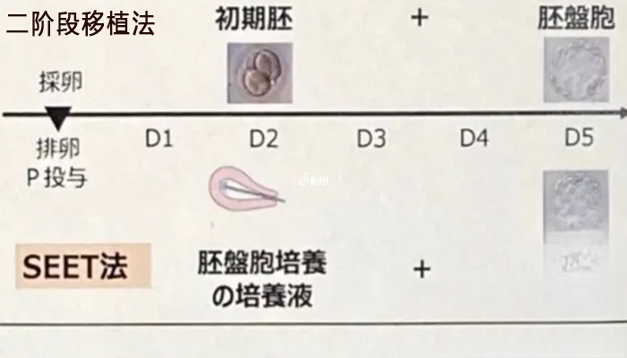 日本有独特的二阶段移植法