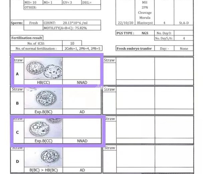 筛查出2个健康胚胎