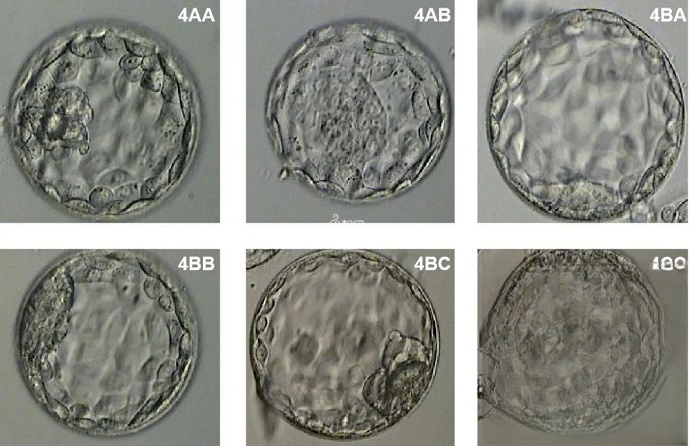 囊胚等级划分表