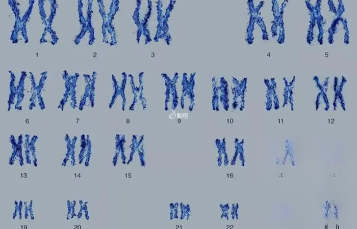 pgd技术可实现染色体非整倍体检测