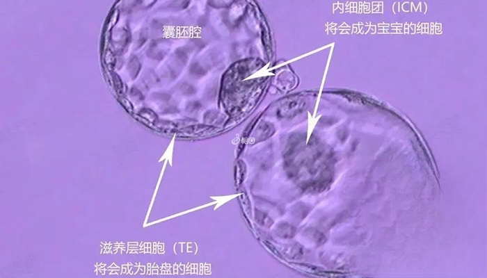 囊胚由三部分来进行级别划分