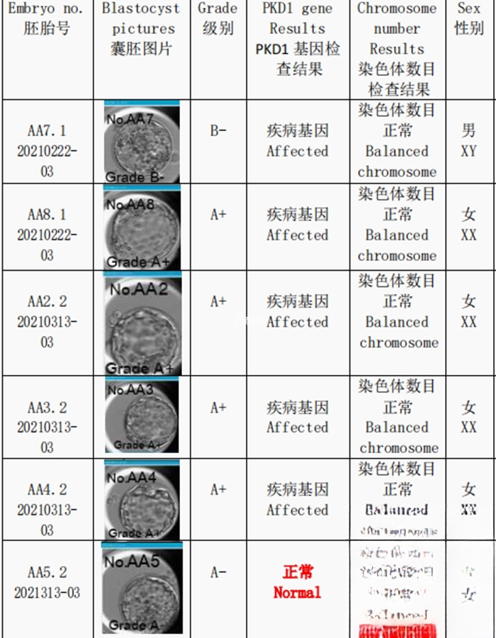 筛查报告1