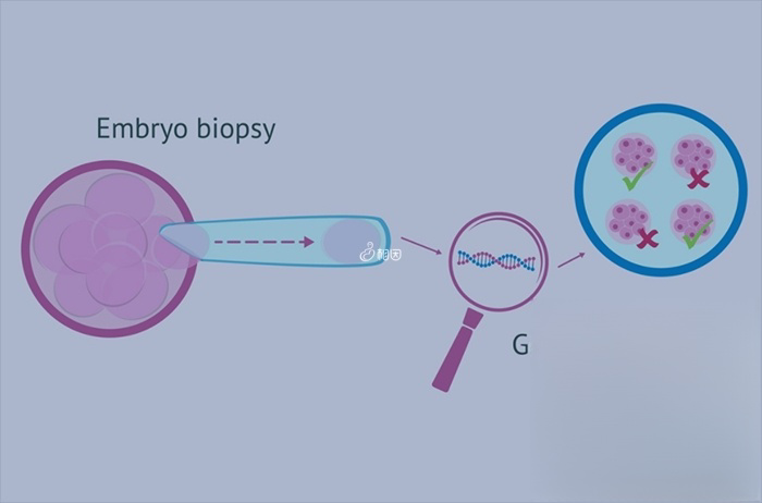 PGD技术可以筛查125种隐性疾病