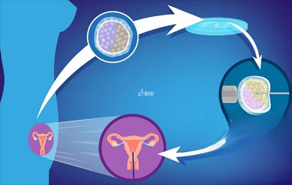 美国做试管婴儿助孕有6大步骤