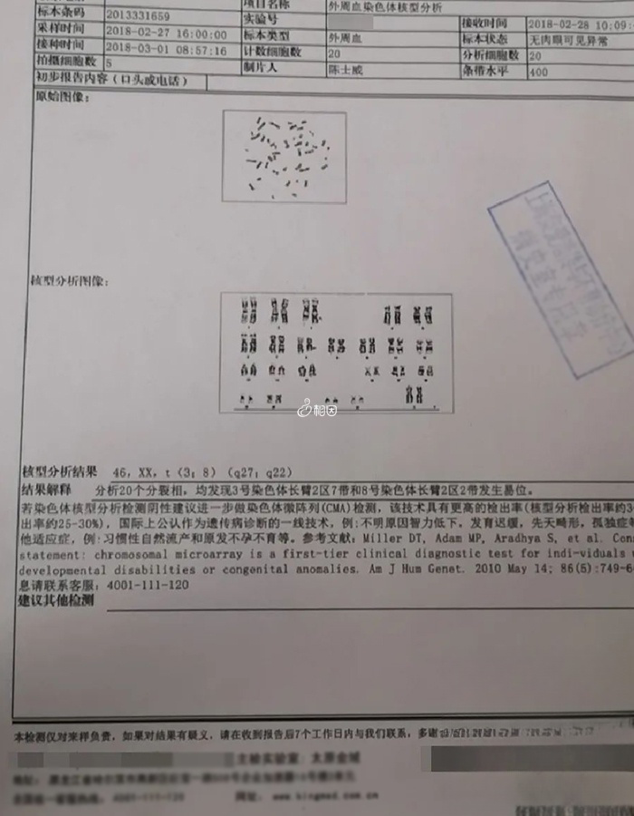 染色体检查结果