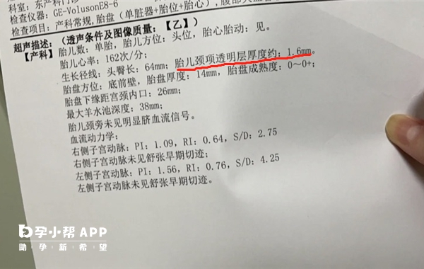 NT值大于1.5是生男孩