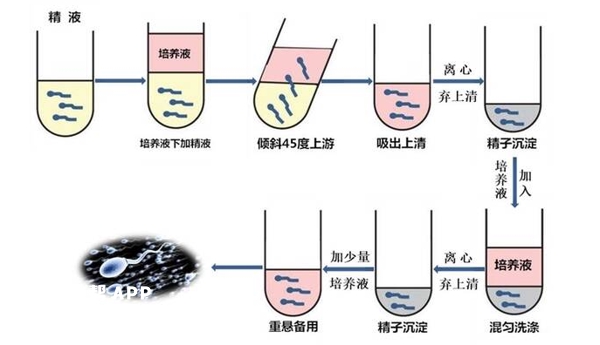 xy精子的分离方法