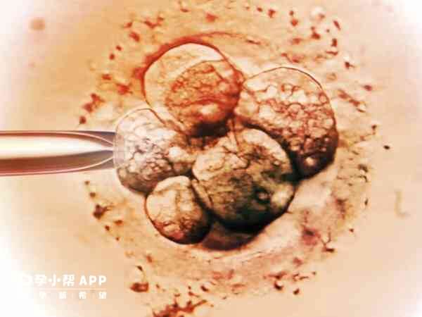 反复胎停需要做检查判断能否做试管