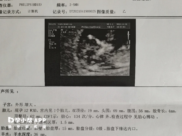 NT检查报告单