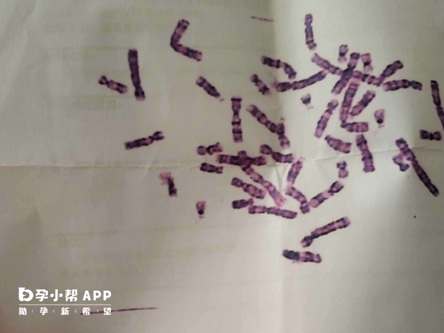 反复性胎停可能是染色体异常导致