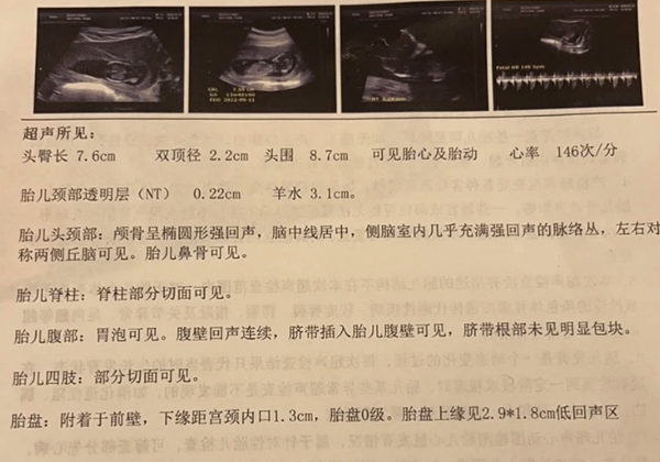 NT检查数据