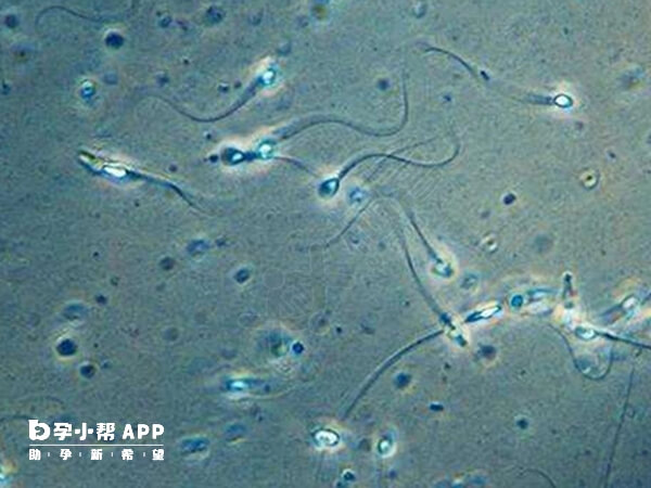 经常锻炼能预防无精症