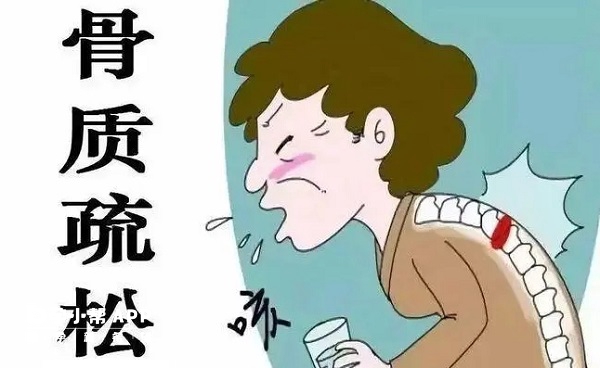 克龄蒙有预防骨质疏松的作用