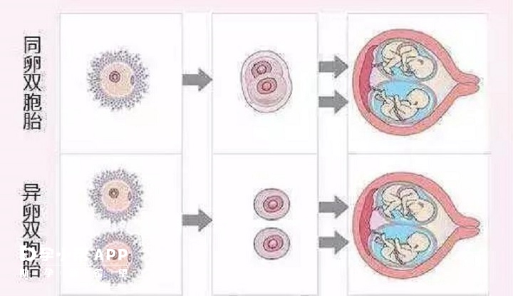 同卵双胞胎与异卵双胞胎