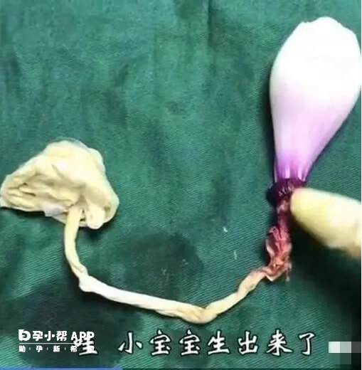 洋葱模仿剖腹产第4步