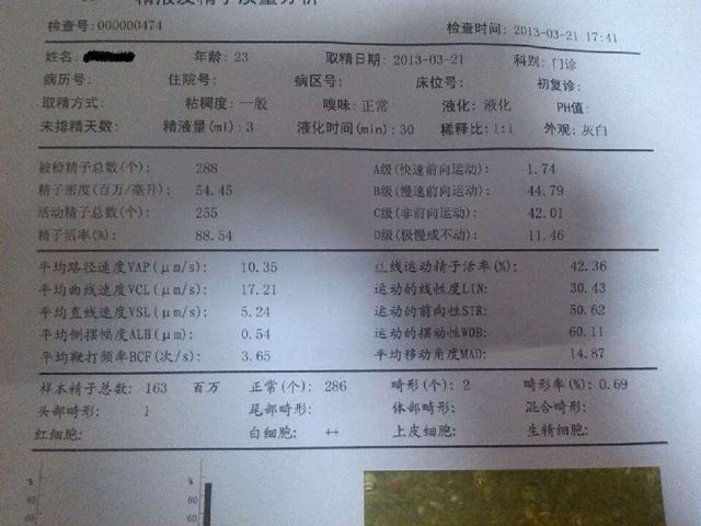 精液常规检查项目报告