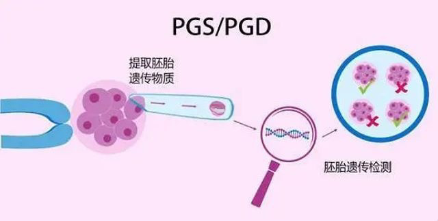 PGD和PGS技术