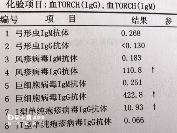 备孕期和孕早期女性建议做torch检查