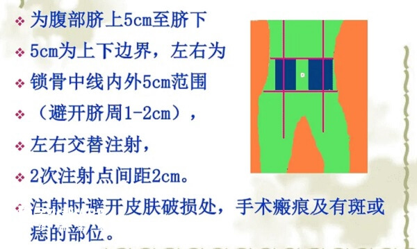 金赛恒是皮下注射药物